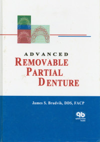 Advanced Removable Partial Denture