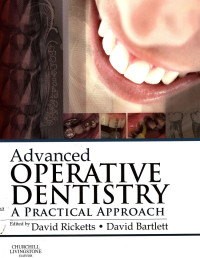 Advanced operative dentistry: A Pratical Approach