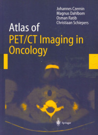 Atlas of PET/CT Imaging in Oncology