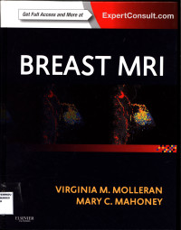 Breast MRI