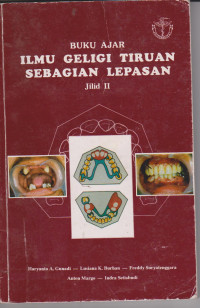 Buku Ajar Ilmu Geligi Tiruan Sebagian Lepasan Jilid II