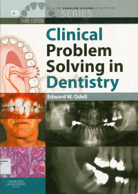 Clinical Problem Soving in Dentistry