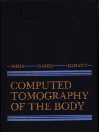 Computer Tomography of the Body