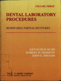 Dental Laboratory Procedure Removable Partial Dentures