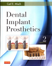 Dental Implant Prosthetics