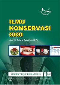 Ilmu Konservasi Gigi