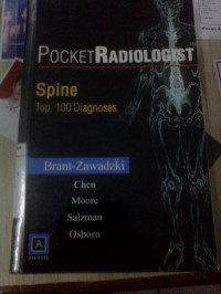 Pocket Radiologist Spine   top 100 Diagnoses