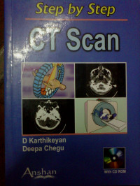 Step by step CT Scan : A Practical Guide For Residents and Technologists