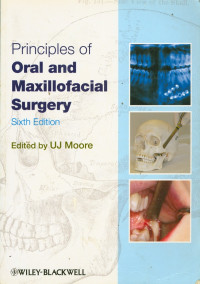 Principles of Oral and Maxillofacial Surgery