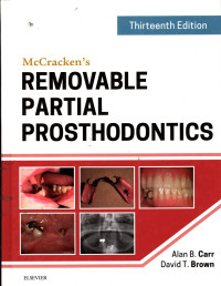 McCracken's Removable Partial Prosthodontics Thirteeth Edition