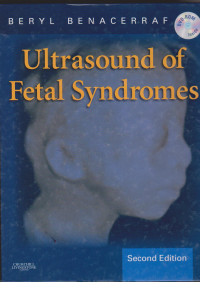 Ultrasound of Fetal Syndromes