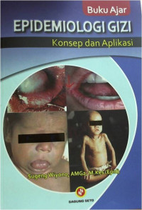 Buku Ajar : Epidemiologi Gizi Konsep dan Aplikasi