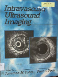 Intravascular Ultrasound Imaging