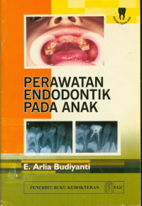 Perawatan Edodontik Pada Anak